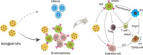 Targeting delivery of mifepristone to endometrial dysfunctional macrophages for endometriosis therapy