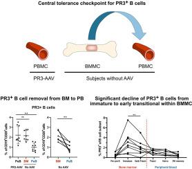 Identification of the central tolerance checkpoint for autoreactive proteinase 3+ B cells in human bone marrow