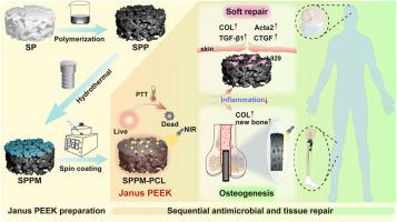 “Janus” PEEK implant with sandwich Mg-containing coating for infected tissue repair