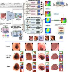 Multi-task learning with cross-task consistency for improved depth estimation in colonoscopy