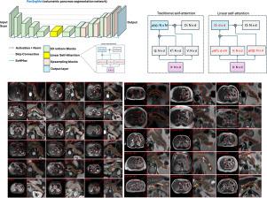 Large-scale multi-center CT and MRI segmentation of pancreas with deep learning