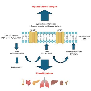 Fatty acid abnormalities in cystic fibrosis–the missing link for a cure?