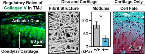 Type V collagen exhibits distinct regulatory activities in TMJ articular disc versus condylar cartilage during postnatal growth and remodeling