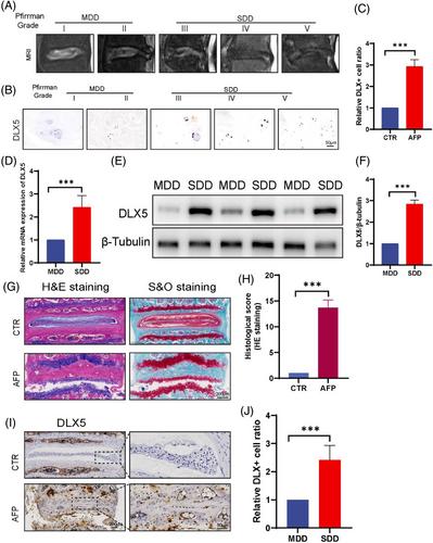 Melatonin attenuates degenerative disc degression by downregulating DLX5 via the TGF/Smad2/3 pathway in nucleus pulposus cells