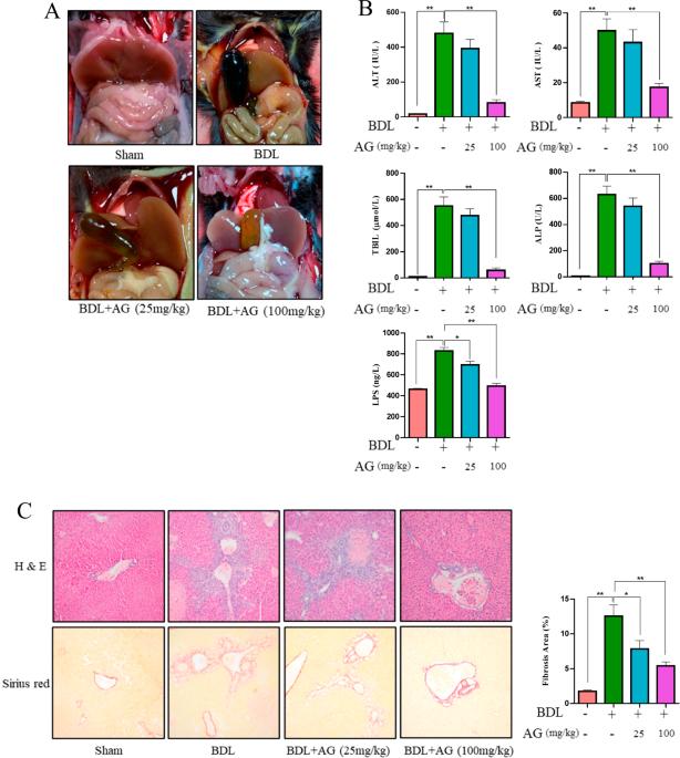 Ampelopsis grossedentata tea alleviating liver fibrosis in BDL-induced mice via gut microbiota and metabolite modulation