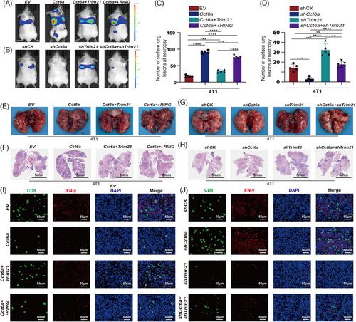 Chaperonin-containing TCP1 subunit 6A inhibition via TRIM21-mediated K48-linked ubiquitination suppresses triple-negative breast cancer progression through the AKT signalling pathway.