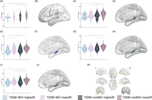 Structural and functional alterations of the hippocampal subfields in T2DM with mild cognitive impairment and insulin resistance: A prospective study