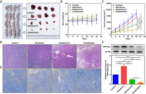 Nodularin-R Synergistically Enhances Abiraterone Against Castrate- Resistant Prostate Cancer via PPP1CA Inhibition.