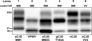 Unsuccessful transmissions of atypical genetic Creutzfeldt–Jakob disease (PRNP p.T183A-129M) in transgenic mice