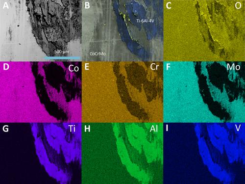 Wear, Material Transfer, and Electrocautery Damage Are Ubiquitous on CoCrMo Femoral Knee Retrievals