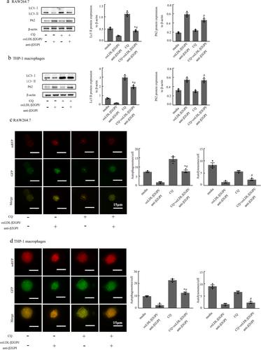 The Effects of the oxLDL/β2GPI/anti-β2GPI Complex on Macrophage Autophagy and its Mechanism