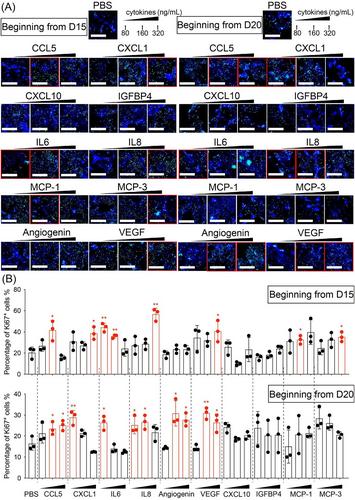 The Abnormal Proliferation of Midbrain Dopamine Cells From Human Pluripotent Stem Cells Is Induced by Exposure to the Tumor Microenvironment