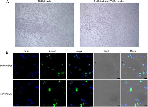 Leukocyte Platelet-Rich Plasma-Derived Exosomes Restrained Macrophages Viability and Induced Apoptosis, NO Generation, and M1 Polarization