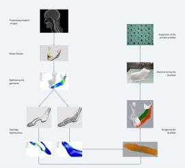 Design of patient-specific mandibular reconstruction plates and a hybrid scaffold