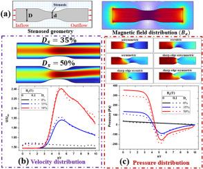 Modelling of coronary artery stenosis and study of hemodynamic under the influence of magnetic fields