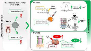 Conditioned media from dental pulp stem cells to counteract age-related macular degeneration