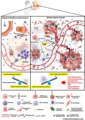 AXL/GAS6 signaling governs differentiation of tumor-associated macrophages in breast cancer