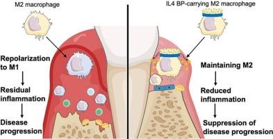 Backpack-carrying macrophage immunotherapy for periodontitis