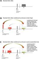 The sensory input, not the motor output, defines blink reflex conditioning