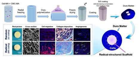 Gradient-coated radial-structured scaffolds for rapid dural regeneration: Providing fast migration pathways and strong migration dynamics