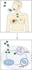 Microplastics accumulated in breast cancer patients lead to mitophagy via ANXA2-mediated endocytosis and IL-17 signaling pathway