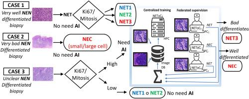 Automatic discrimination between neuroendocrine carcinomas and grade 3 neuroendocrine tumors by deep learning of H&E images