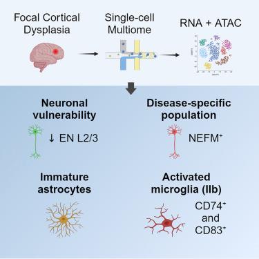 Multimodal single-cell profiling reveals neuronal vulnerability and pathological cell states in focal cortical dysplasia