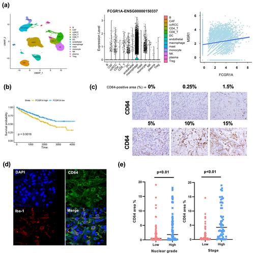 The contribution of the CRP/CD64 axis to renal cancer progression by inducing protumor activation of tumor-associated macrophages