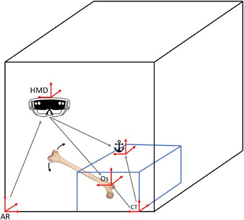 Validation of an Augmented Reality Based Functional Method to Determine and Render the Hip Rotation Centre During Total Hip Arthroplasty