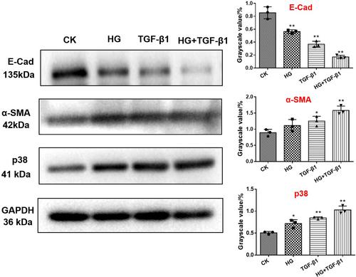 Periostin Induces Epithelial-Mesenchymal Transition via p38-MAPK Pathway in Human Renal Tubular Cells by High Glucose