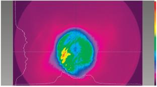 UV Nitrogen Laser Pumped by a Pulsed Longitudinal Inductive-Electric Discharge