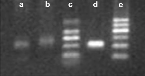 Treatment of primary cutaneous CD30-positive anaplastic large cell lymphoma with Wenyang Shengji decoction and Huanglian ointment: A case report