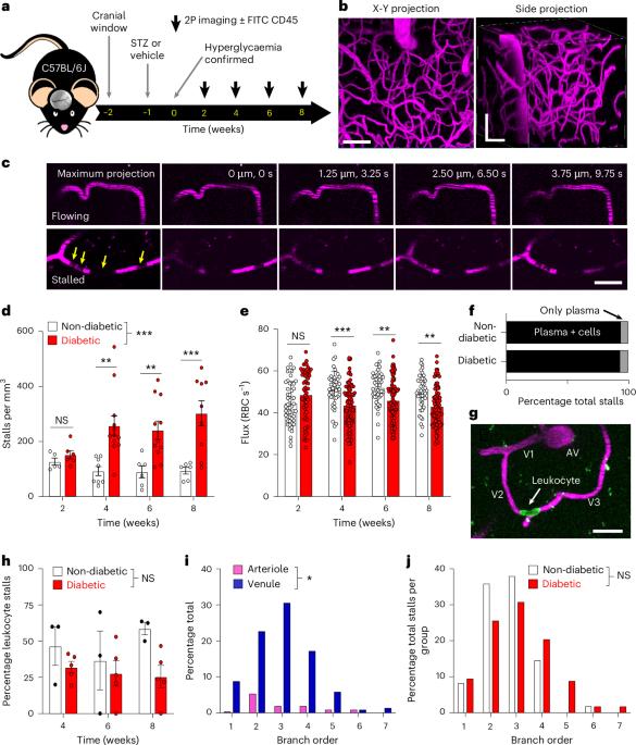 A pathogenic role for IL-10 signalling in capillary stalling and cognitive impairment in type 1 diabetes