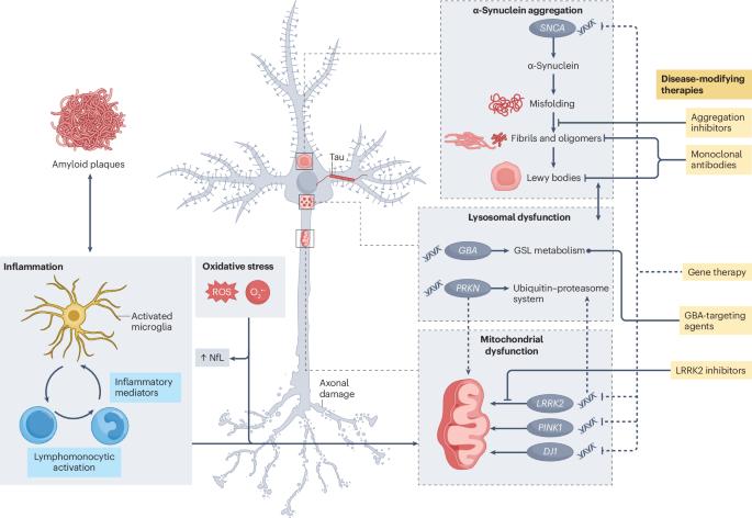 Parkinson disease therapy: current strategies and future research priorities