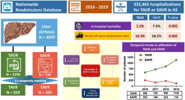 In-Hospital Outcomes and 30-Day Readmission Rate After Transcatheter and Surgical Aortic Valve Replacement in Liver Cirrhosis: A Contemporary Propensity-Matched Analysis