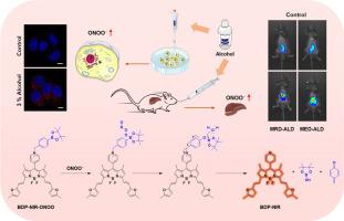 A near-infrared ONOO−-activated fluorescent probe for real-time visualizing of alcoholic liver disease