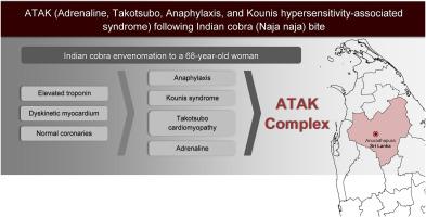 ATAK (Adrenaline, Takotsubo, anaphylaxis, and Kounis hypersensitivity-associated syndrome) following common cobra (Naja naja) bite: A case report from Sri Lanka