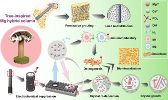 Tree-inspired magnesium hybrid column for preventing hip collapse in steroid-associated osteonecrosis in bipedal emus