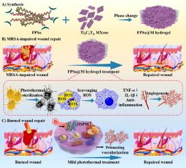 Oxidativestress-scavenging thermo-activated MXene hydrogel for rapid repair of MRSA impaired wounds and burn wounds