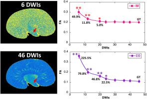 Diffusion tractography of kidney by high angular resolution diffusion imaging