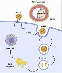 ECH 1 attenuates atherosclerosis by reducing macrophage infiltration and improving plaque stability through CD36 degradation