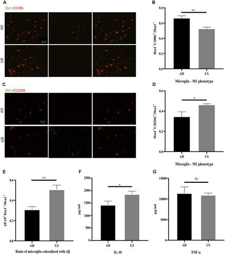 Ultrasound Stimulation Modulates Microglia M1/M2 Polarization and Affects Hippocampal Proteomic Changes in a Mouse Model of Alzheimer's Disease