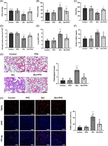 Pirfenidone alleviates smoke inhalation lung injury of rats via the NF-κB signaling pathway