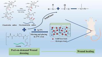 A chondroitin sulfate-based temperature-responsive hydrogel with antimicrobial properties for epidermal wound repair in diabetic patients