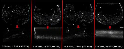 Acoustic-induced flow on the evaporation dynamics of twin drops