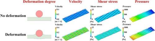 Dissecting spacer induced membrane deformation and fluid hydraulic behavior in reverse osmosis