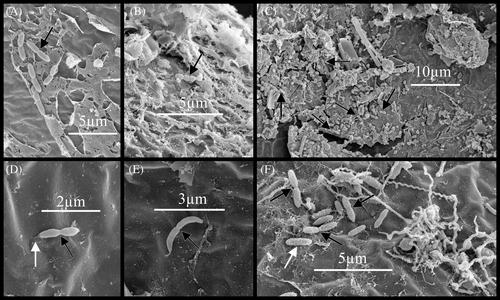 Assessment of the cyst wall and surface microbiota in dormant embryos of the Antarctic calanoid copepod, Boeckella poppei