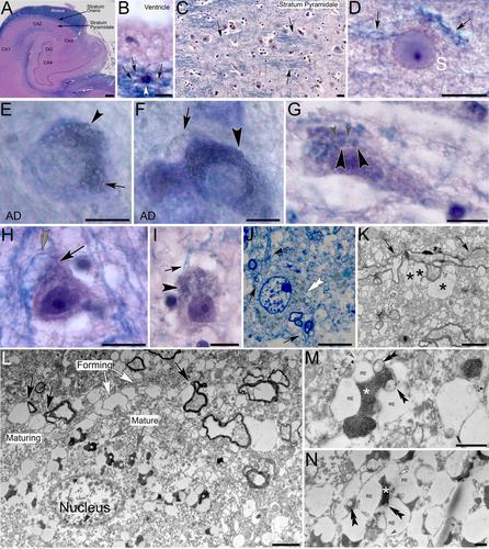Myelinated Glial Cells: Their Proposed Role in Waste Clearance and Neurodegeneration in Arachnid and Human Brain