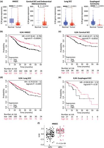 Squamous cell carcinoma is associated with reduced IL34 expression, alterations in the Langerhans cell antigen-processing-presentation machinery and poor patient survival