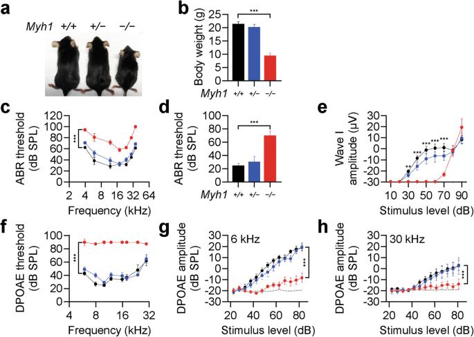 MYH1 deficiency disrupts outer hair cell electromotility, resulting in hearing loss